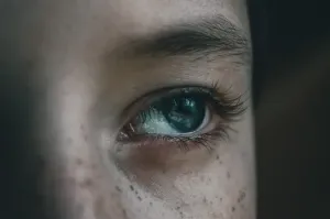 Blefaroplastyka